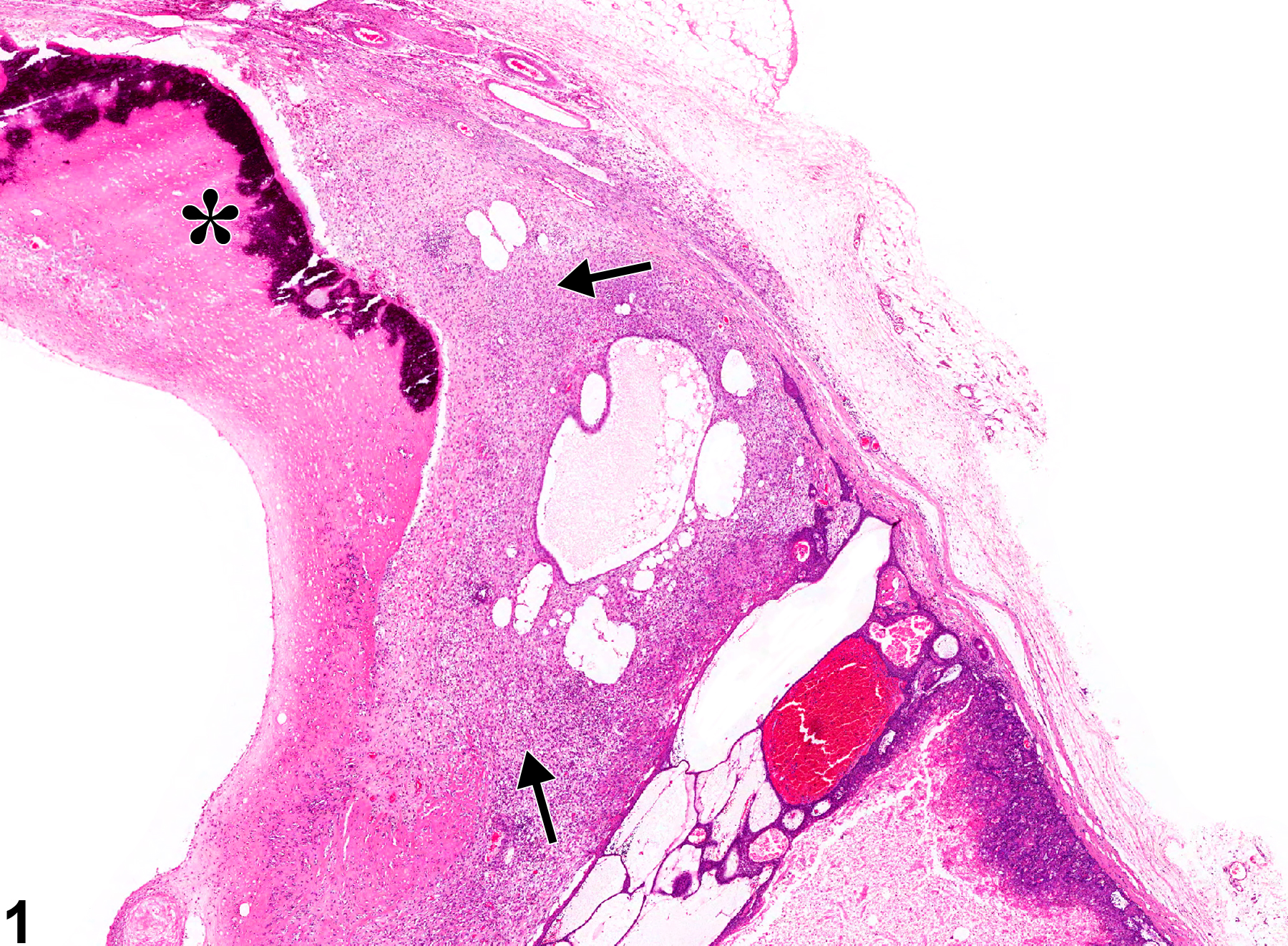 Image of metaplasia, osseous in the preputial gland from a male F344/N rat in a chronic study