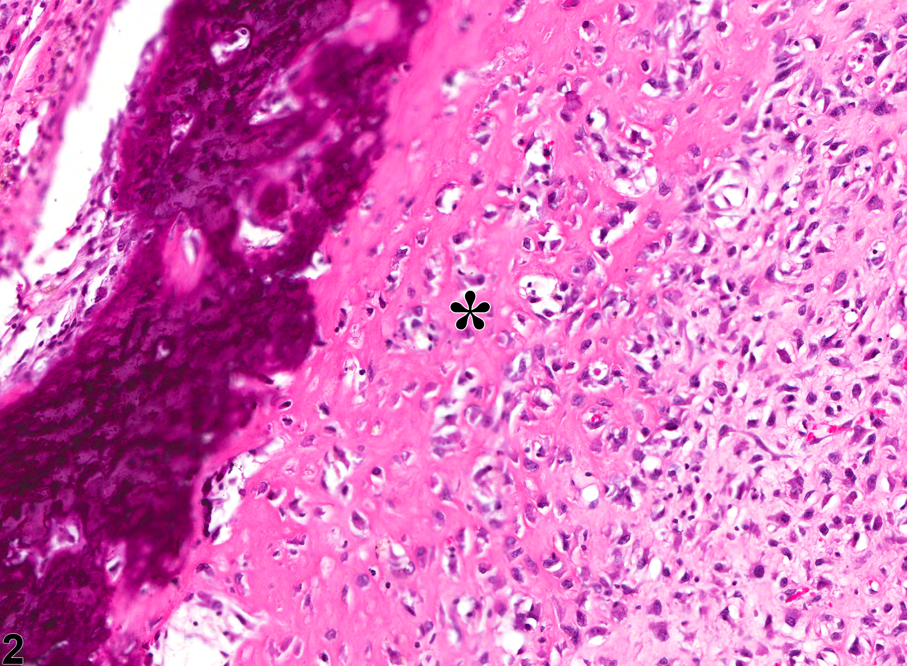 Image of metaplasia, osseous in the preputial gland from a male F344/N rat in a chronic study