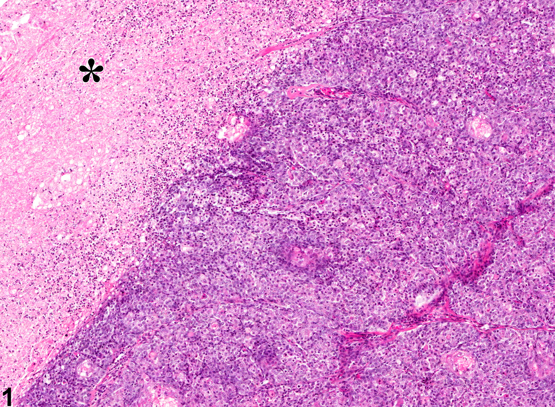 Image of necrosis in the preputial gland from a male F344/N rat in a chronic study
