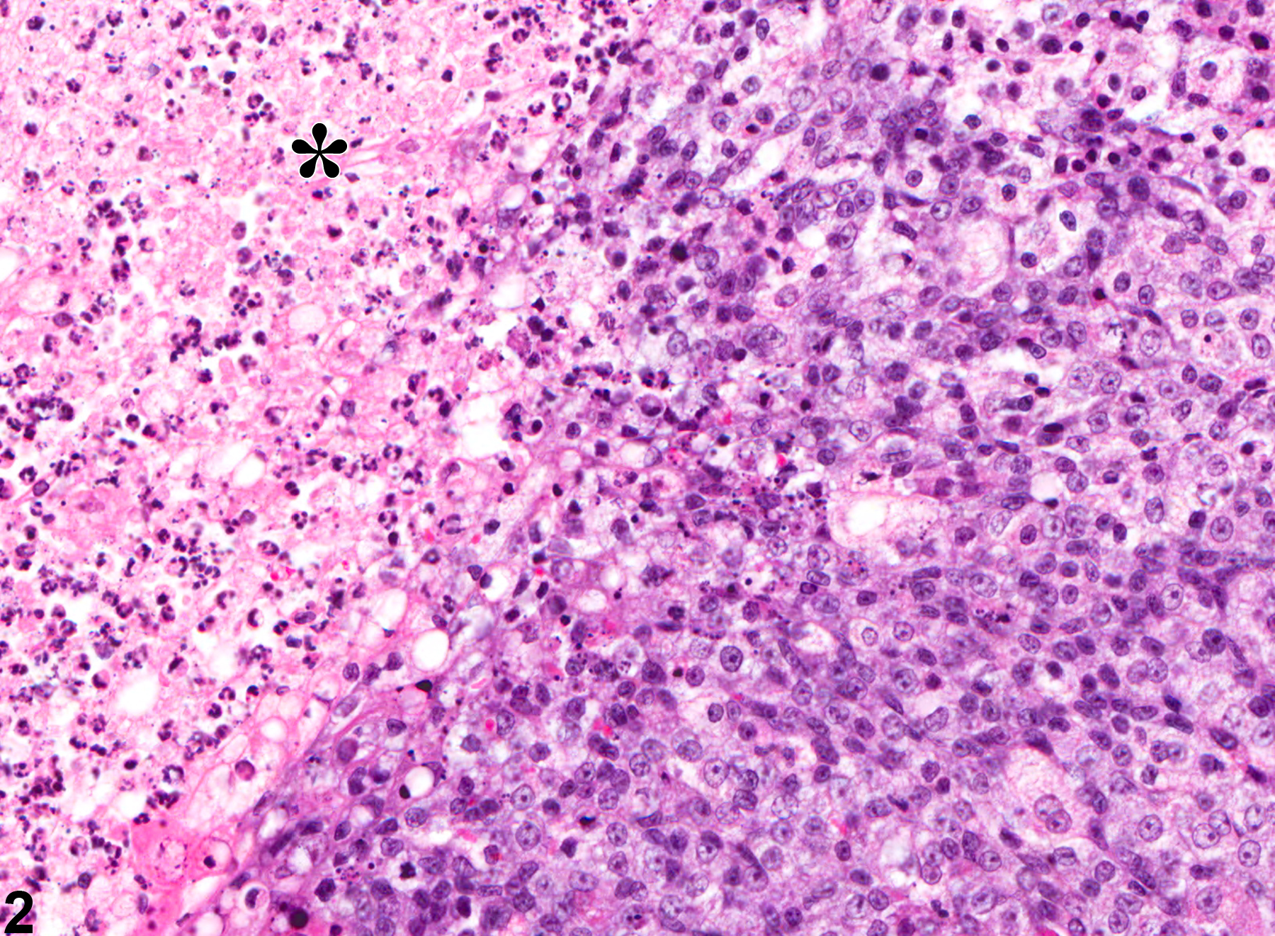 Image of necrosis in the preputial gland from a male F344/N rat in a chronic study