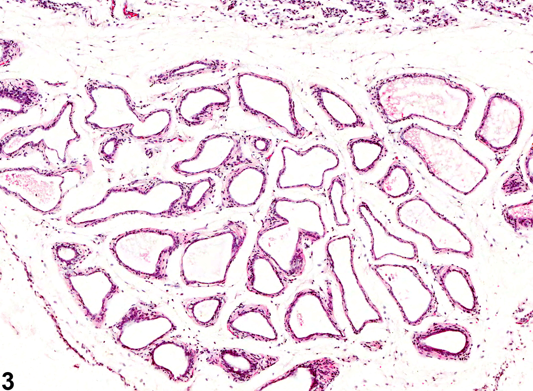 Image of acinar atrophy in the prostate from a male F344/N rat in a subchronic study
