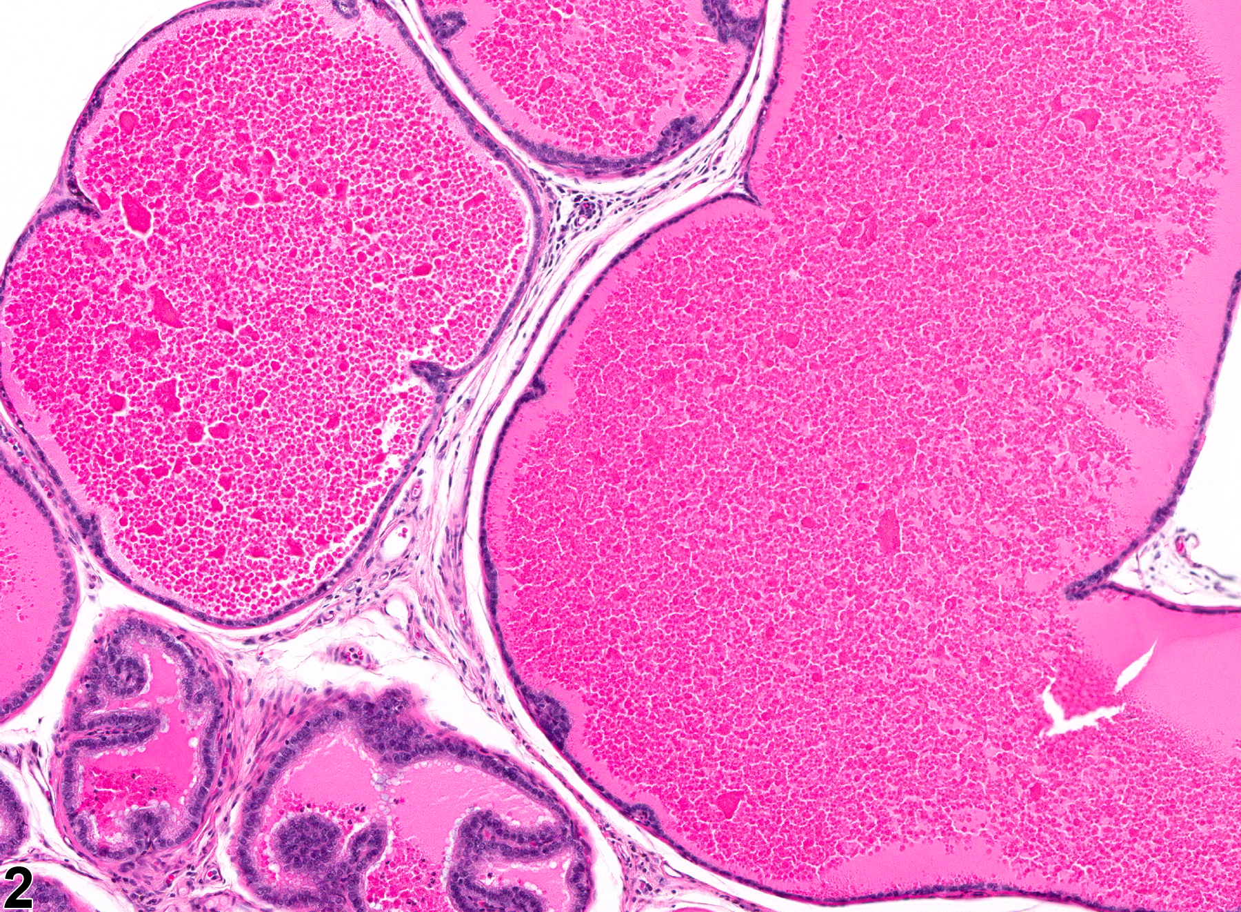 Image of acinar dilation in the prostate from a male F344/N rat in a chronic study
