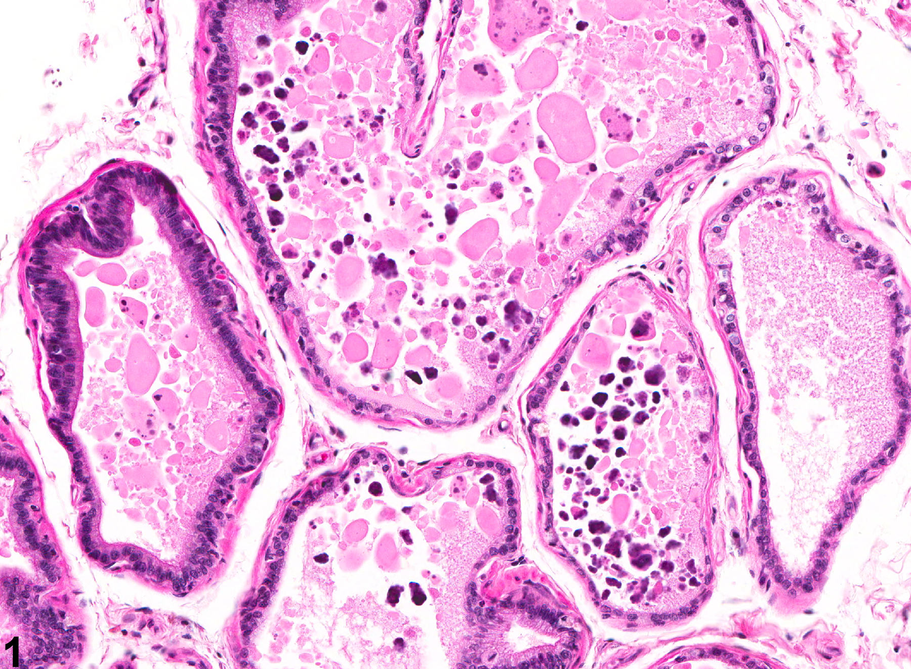 Image of acinar secretory alteration in the prostate from a male F344/N rat in a chronic study
