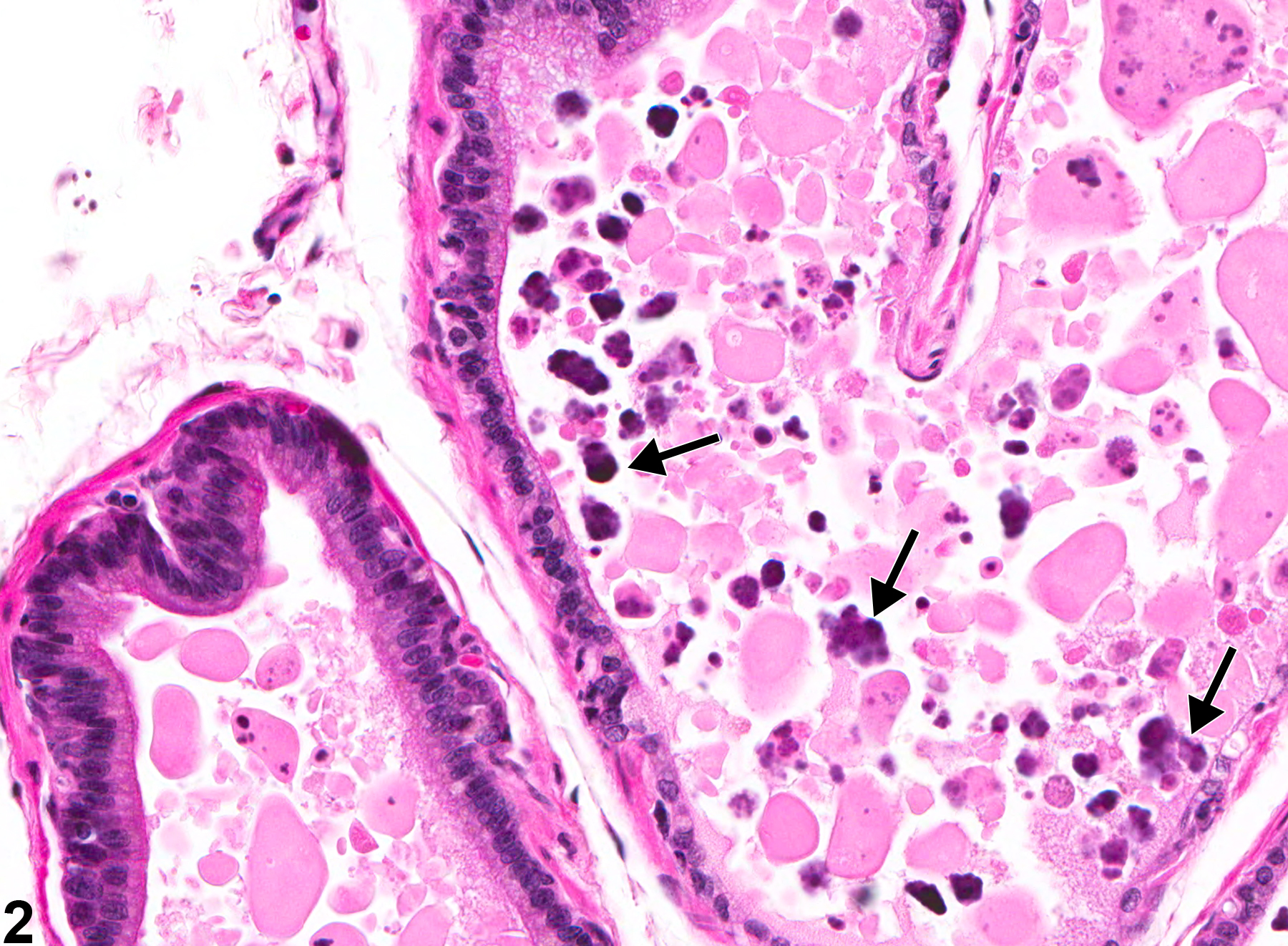 Image of acinar secretory alteration in the prostate from a male F344/N rat in a chronic study