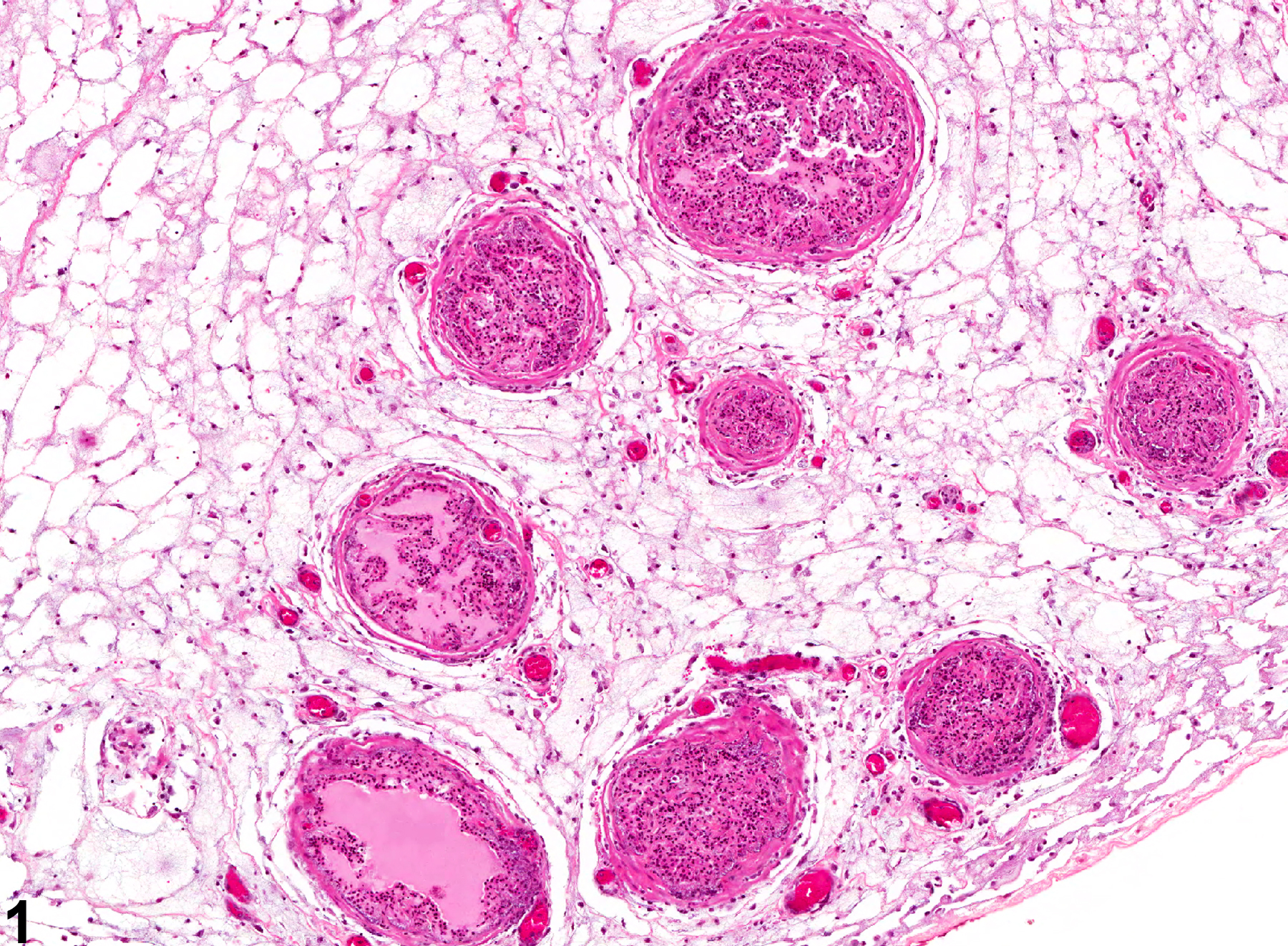Image of edema in the prostate from a male F344/N rat in a chronic study