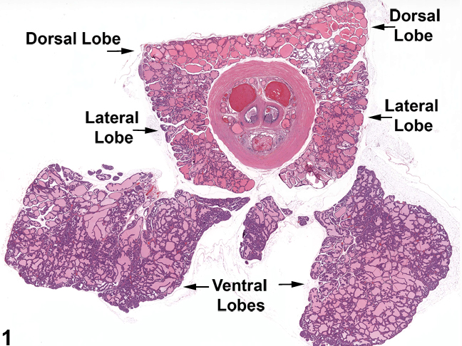 Image of normal lobes in the prostate