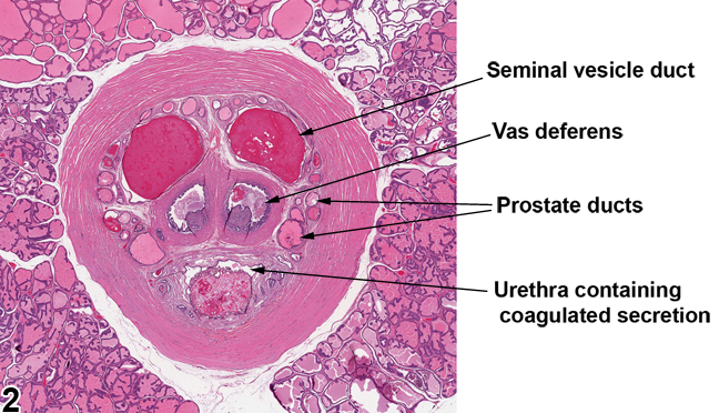 Image of normal ducts in the prostate
