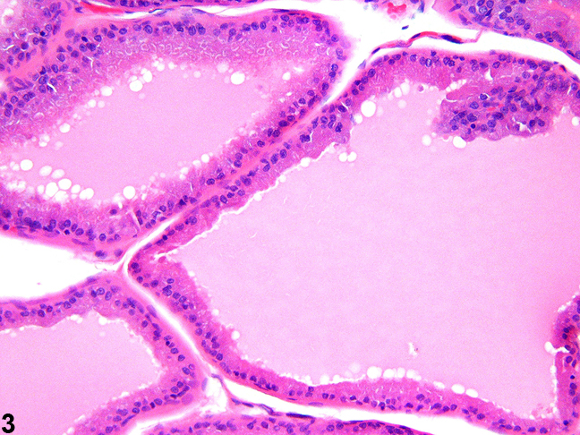 Image of cuboidal to columnar epithelial lining in the prostate