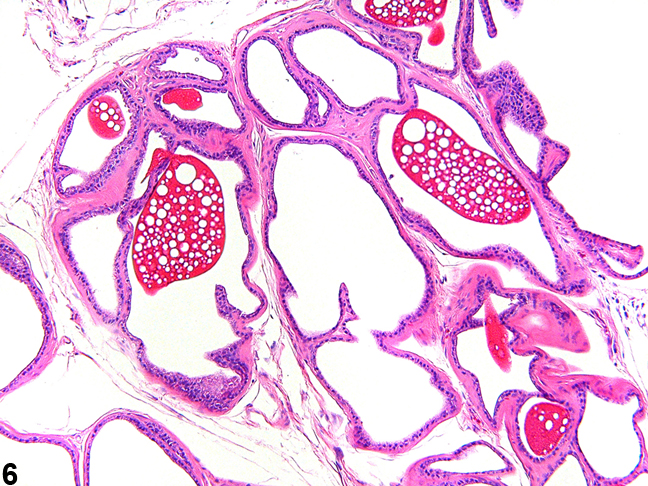 Image of normal ampullary gland