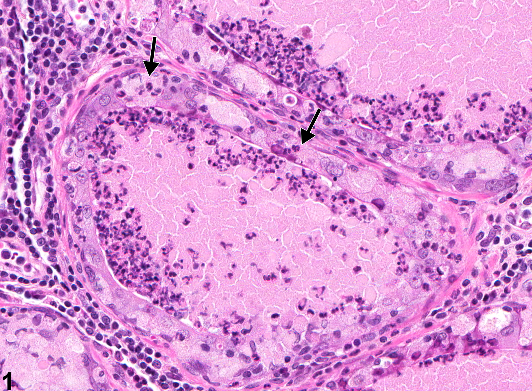 Image of inflammation in the prostate from a male F344/N rat in a chronic study