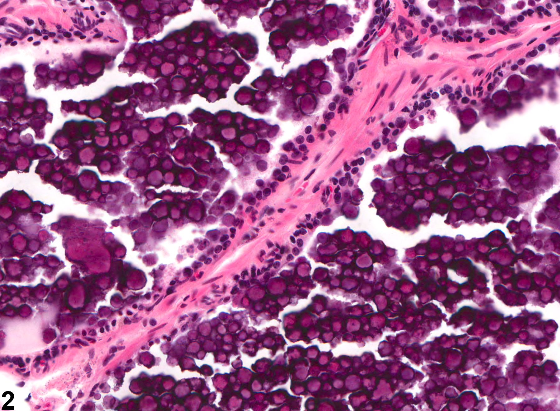Image of mineralization in the prostate from a male Osborne-Mendel rat in a chronic study