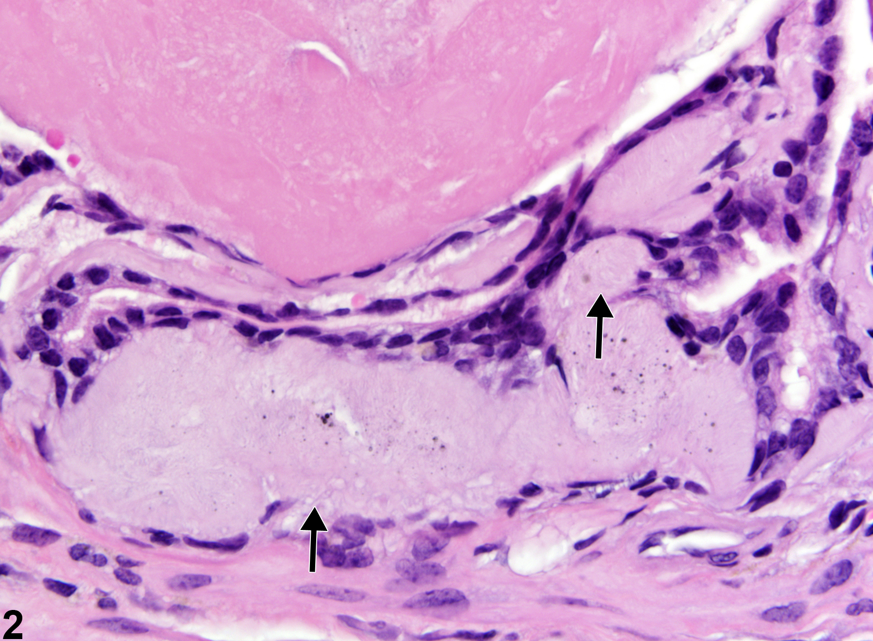 Image of amyloid in the seminal vesicle from a male B6C3F1 mouse in an chronic study