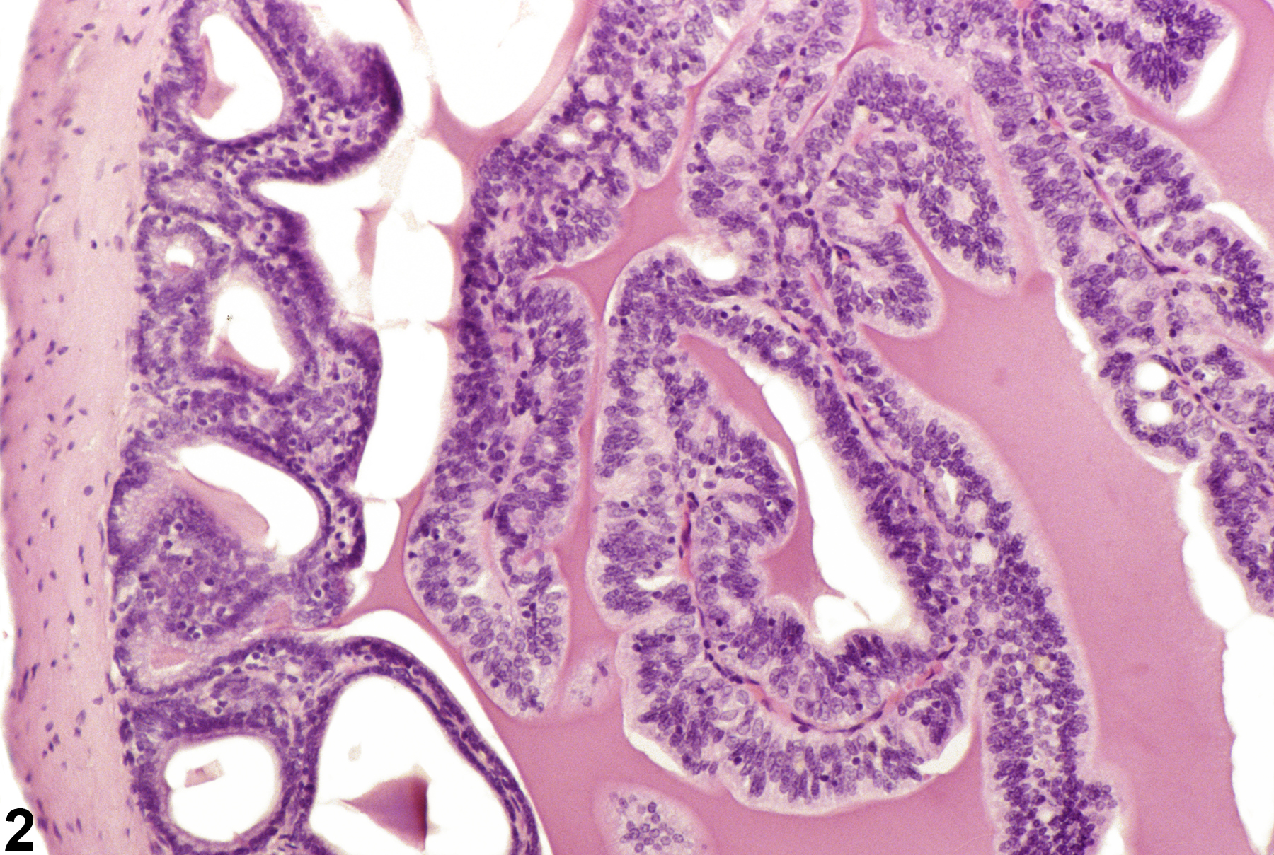 Image of epithelial hyperplasia in the seminal vesicle from a male F344/N rat in an chronic study