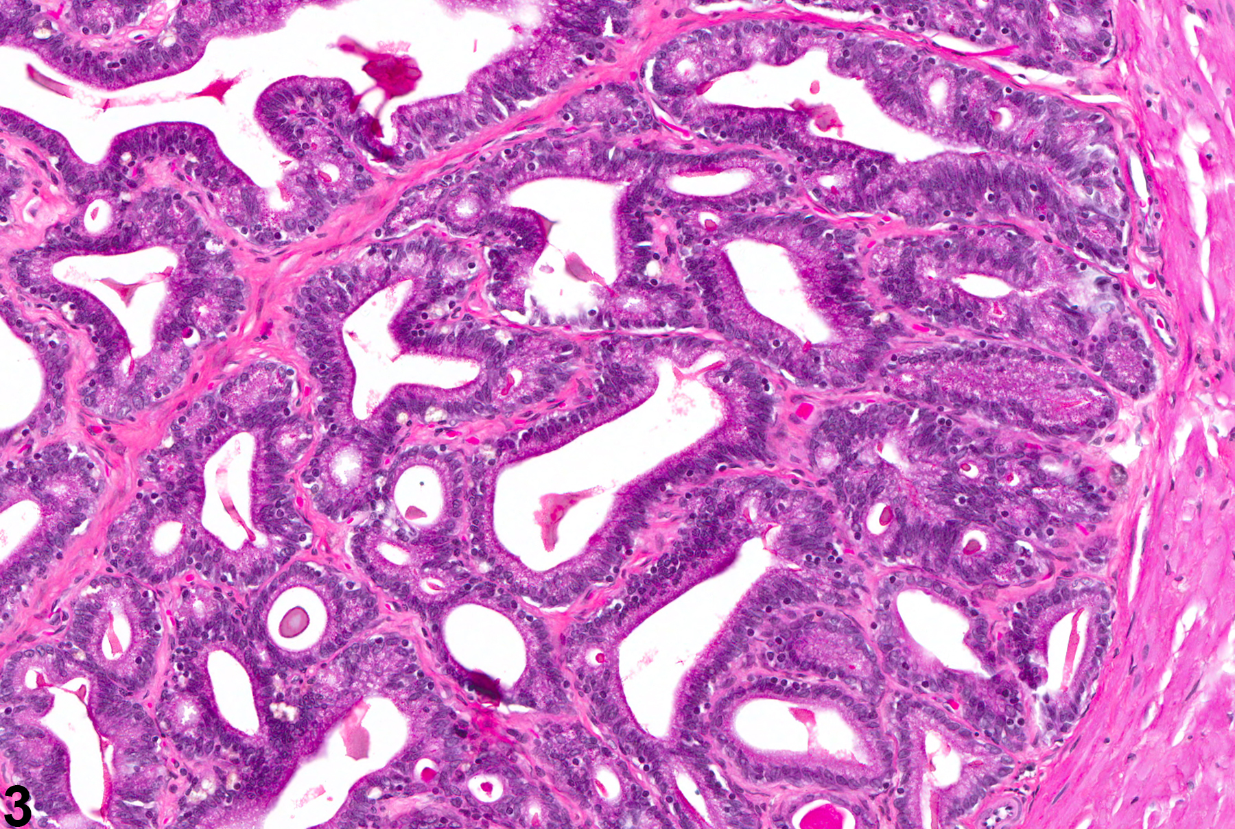 Image of epithelial hyperplasia in the seminal vesicle from a male F344/N rat in an chronic study