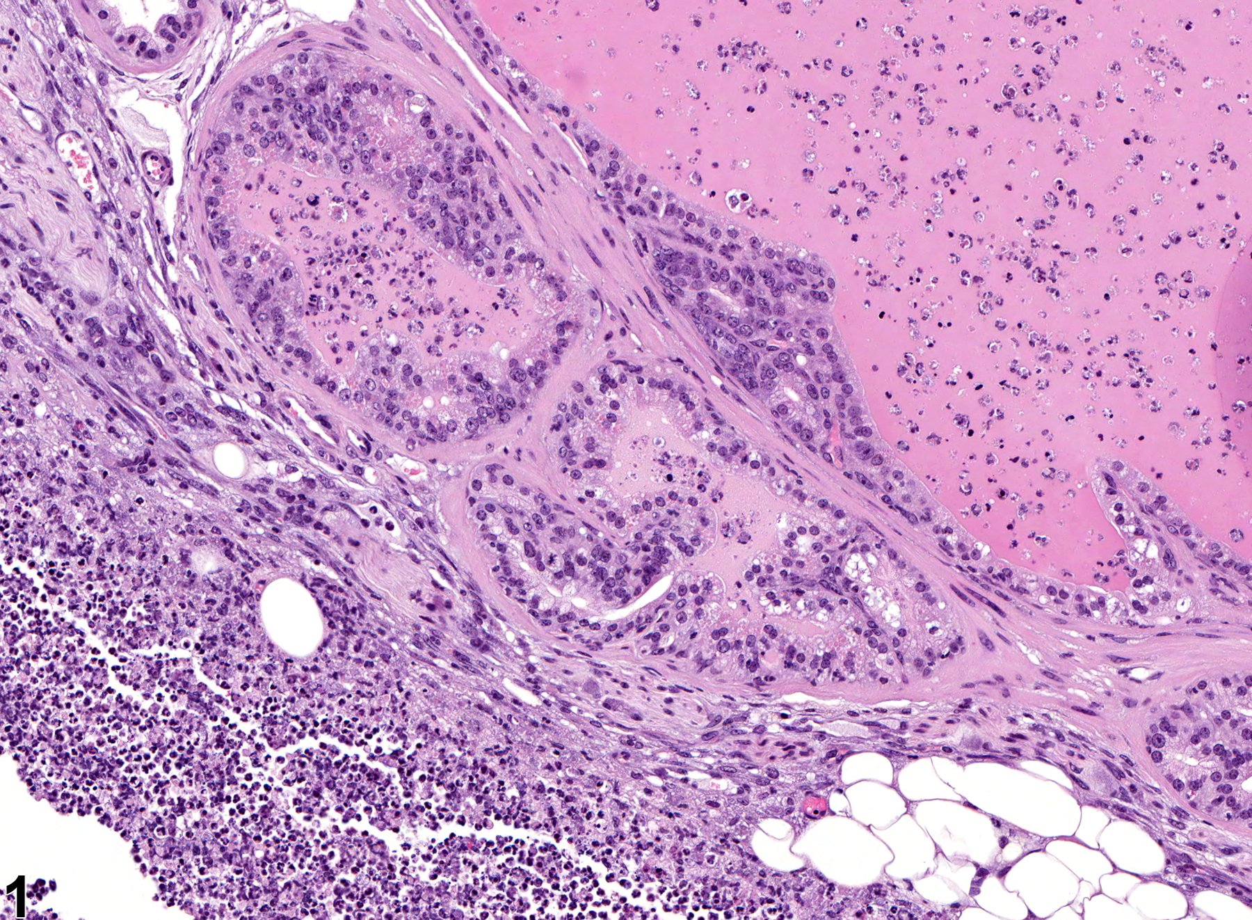 Image of inflammation in the seminal vesicle from a male B6C3F1 mouse in an chronic study