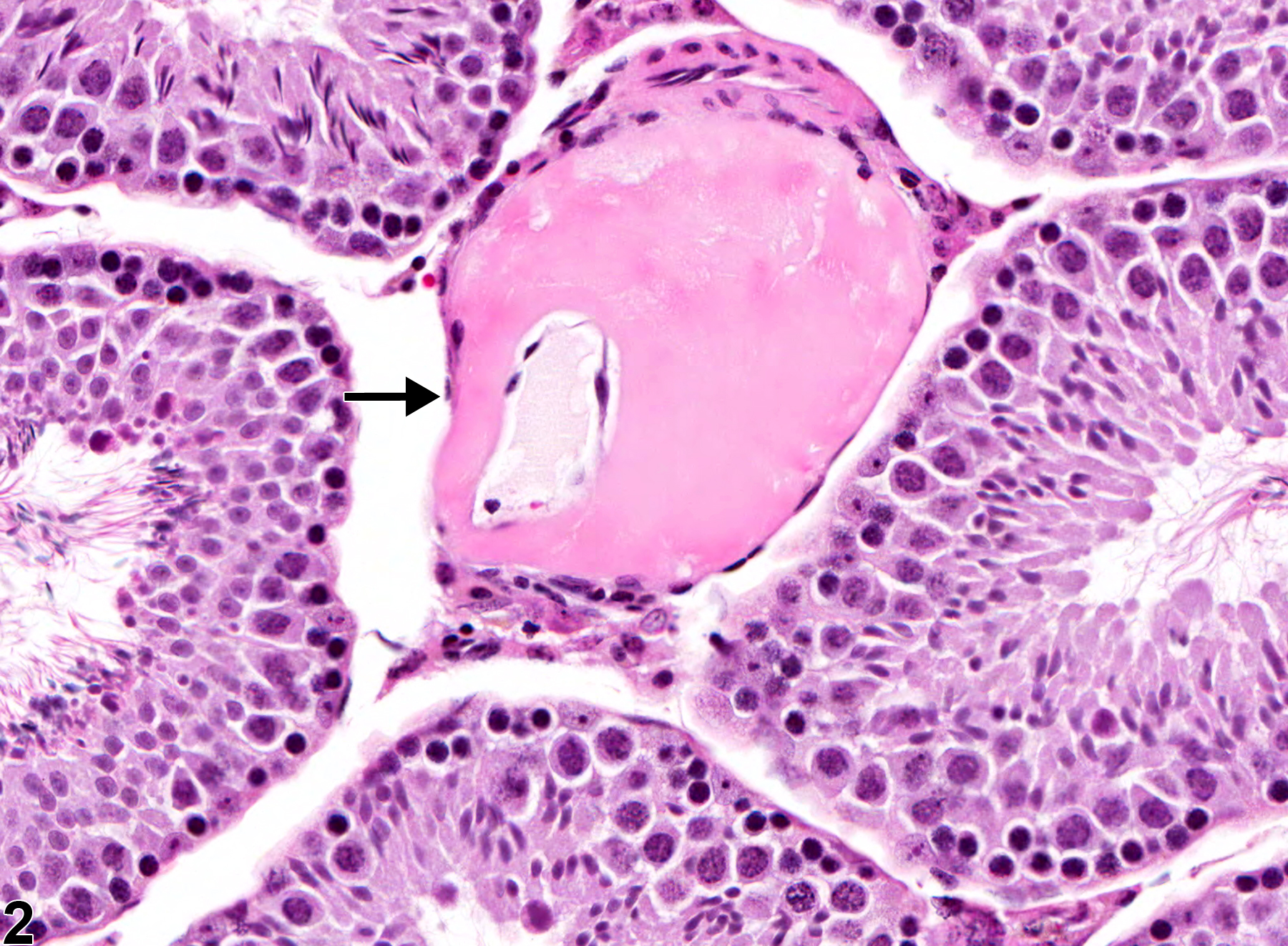Image of amyloid in the testis from a male B6C3F1 mouse in a chronic study