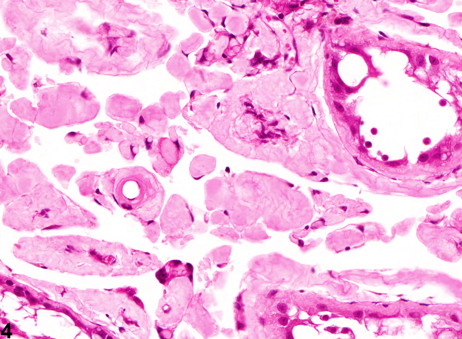 Image of amyloid in the testis from a male Swiss CD-1 mouse in a chronic study