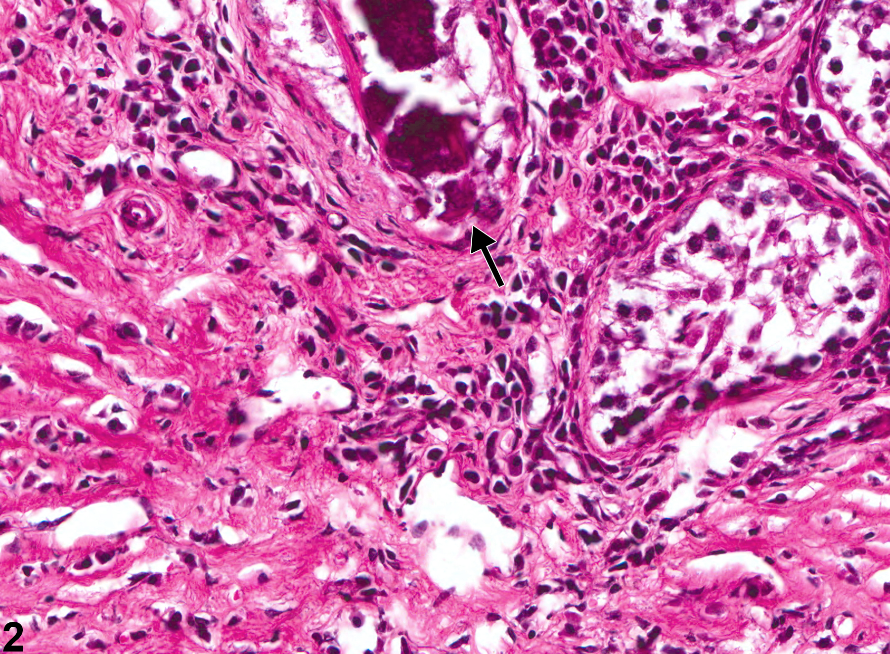 Image of fibrosis in the testis from a male Swiss CD-1 mouse in a chronic study