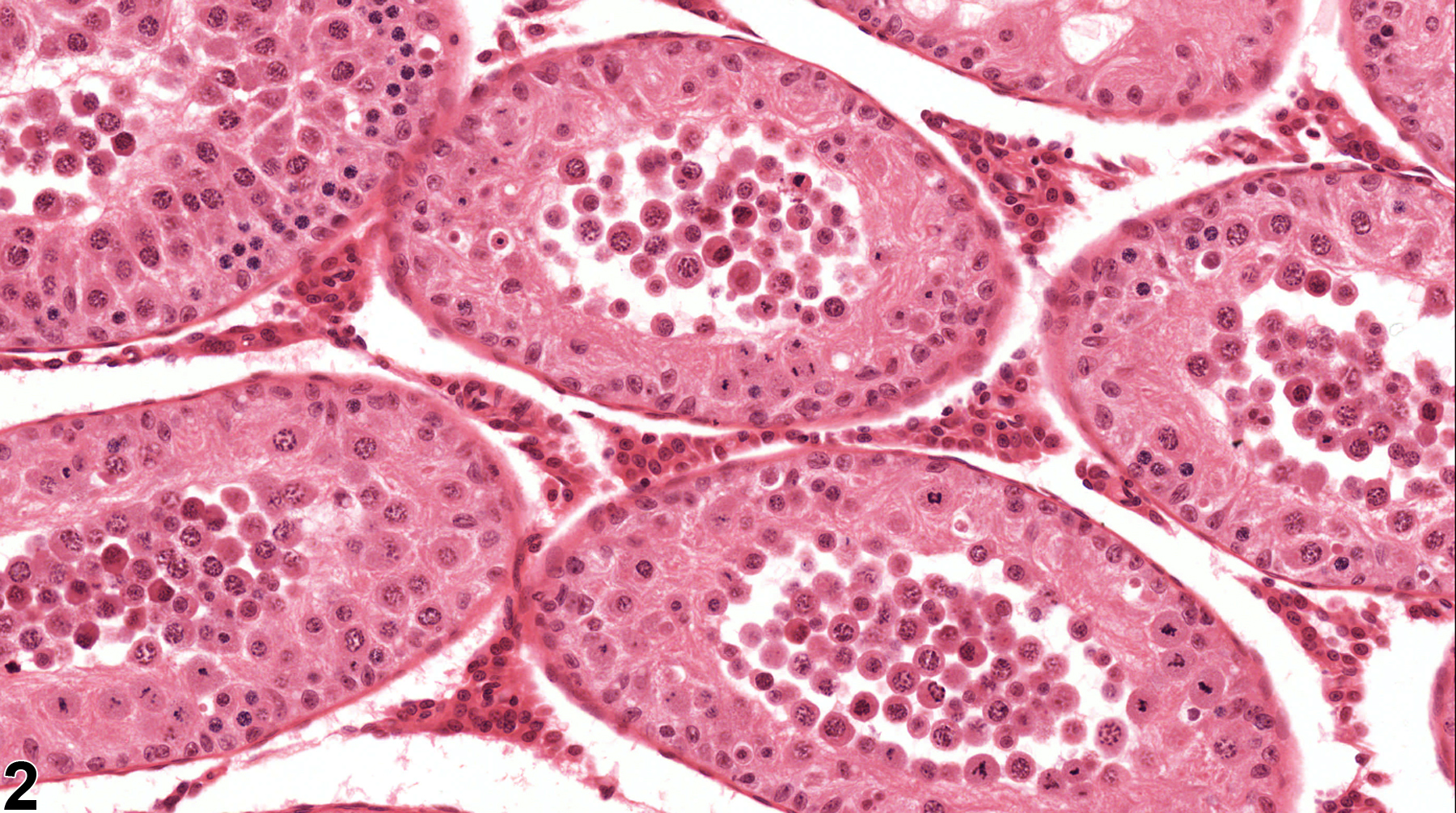 Image of germ cell exfoliation in the testis from a male Harlan Sprague-Dawley rat