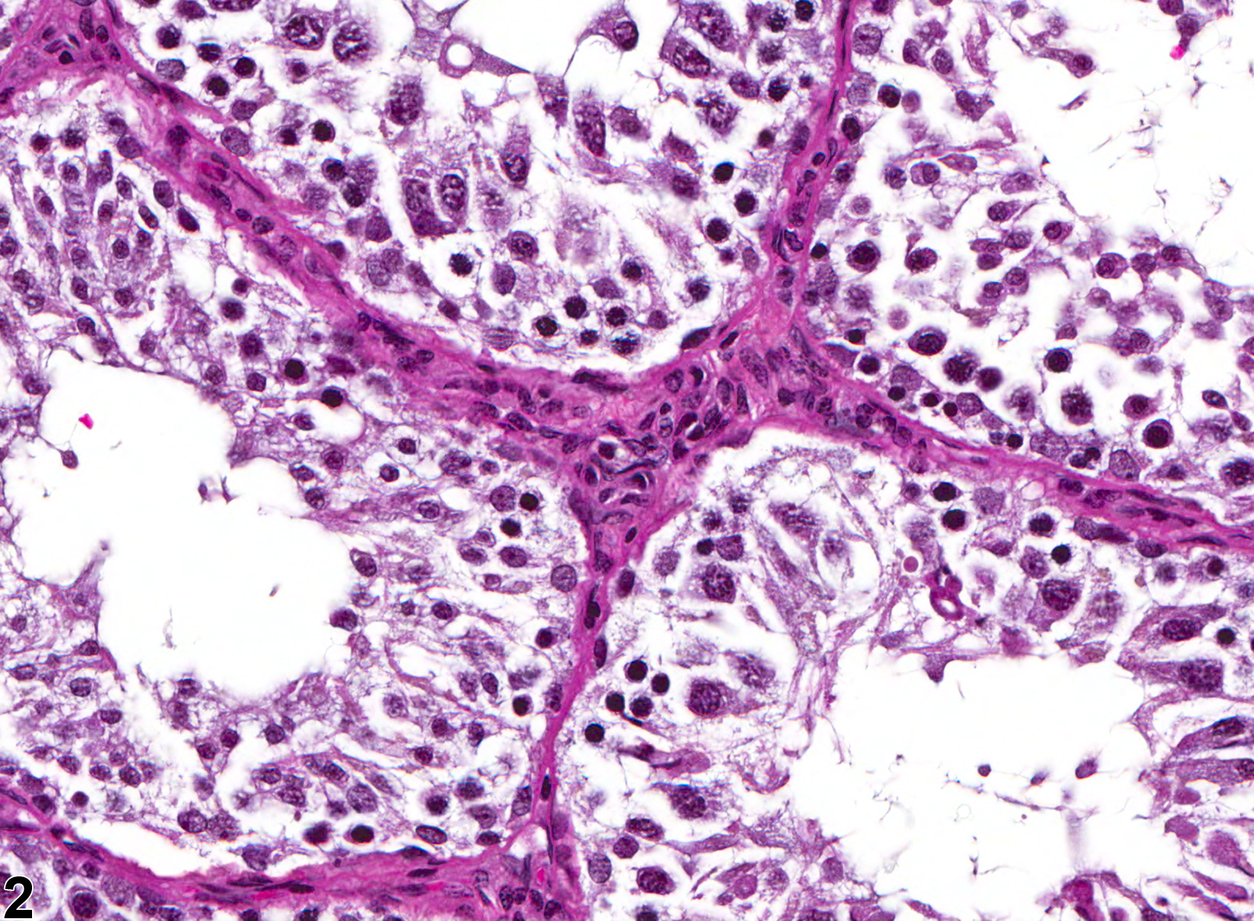 Image of germinal epithelium degeneration in the testis from a male F344/N rat in a chronic study