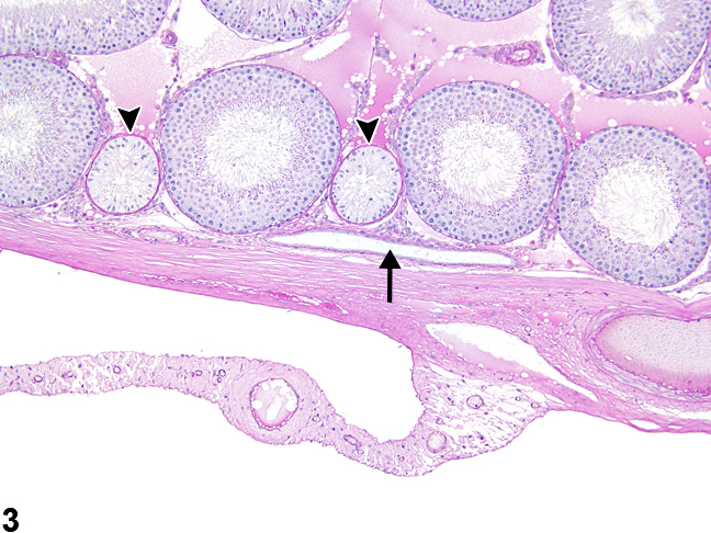 Image of normal rete testis in the testis from a male Harlan Sprague-Dawley rat in a multigenerational reproduction study