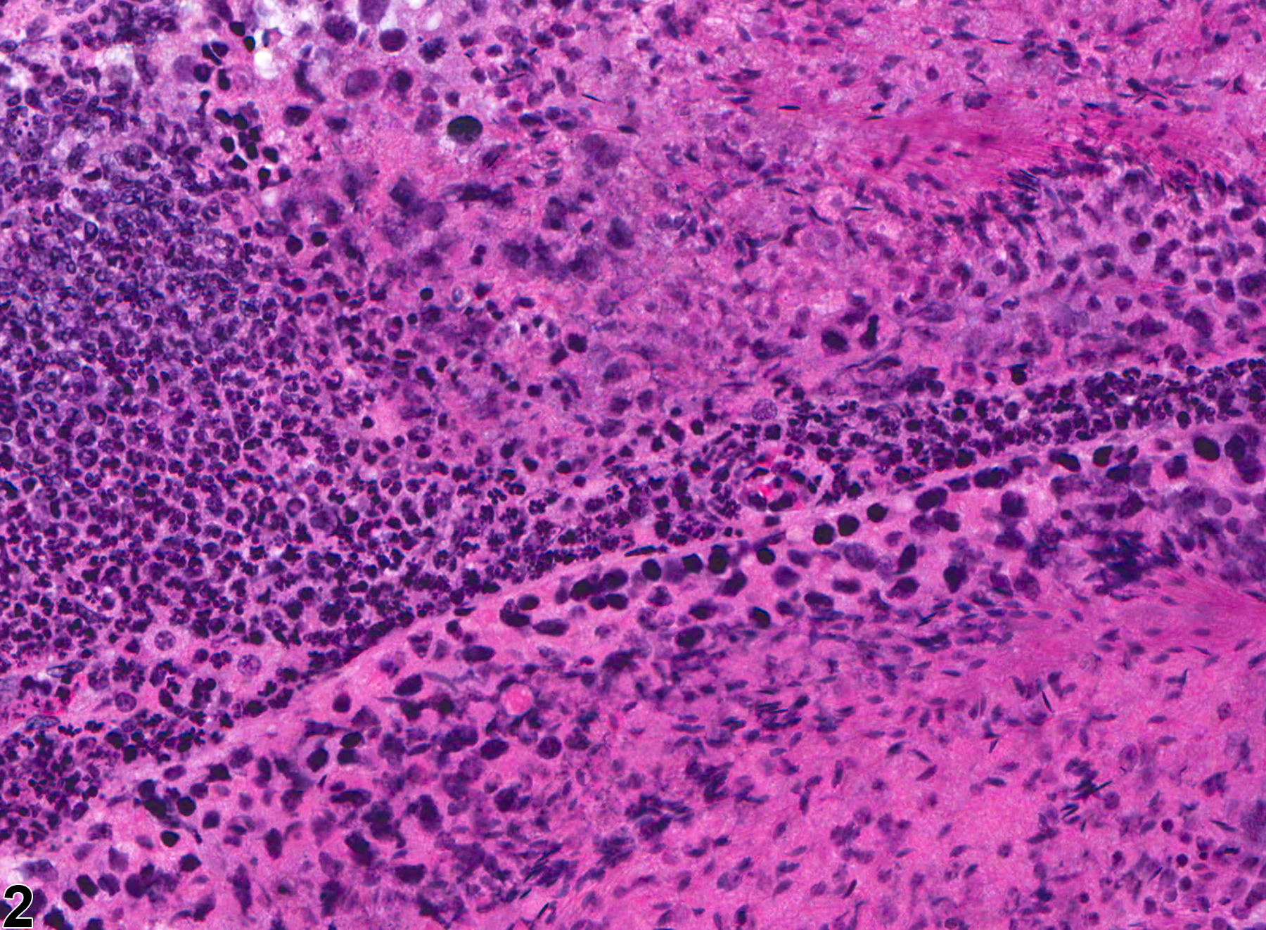 Image of inflammation in the testis from a male B6C3F1 mouse in a chronic study