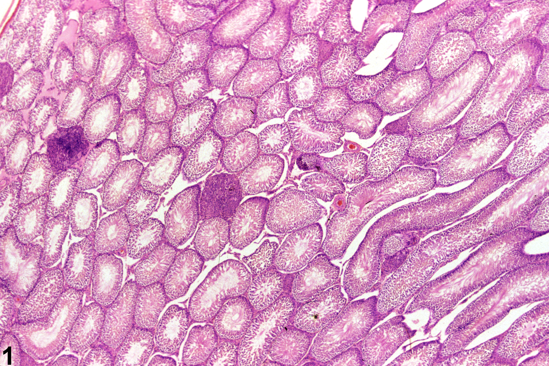 Image of interstitial cell hyperplasia in the testis from a male F344/N rat in a chronic study