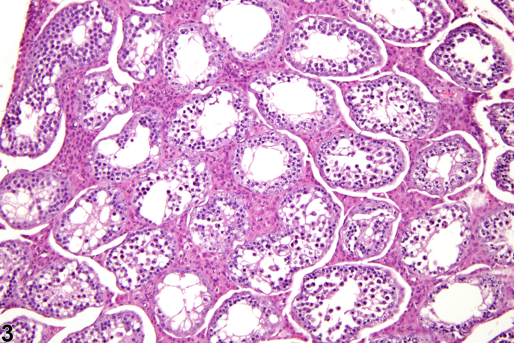 Image of interstitial cell hyperplasia in the testis from a male B6C3F1 mouse in a chronic study