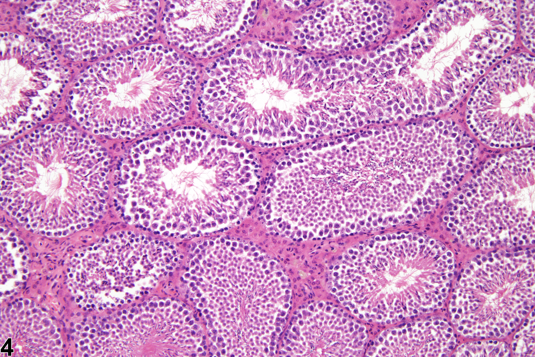 Image of interstitial cell hyperplasia in the testis from a male B6C3F1 mouse in a chronic study