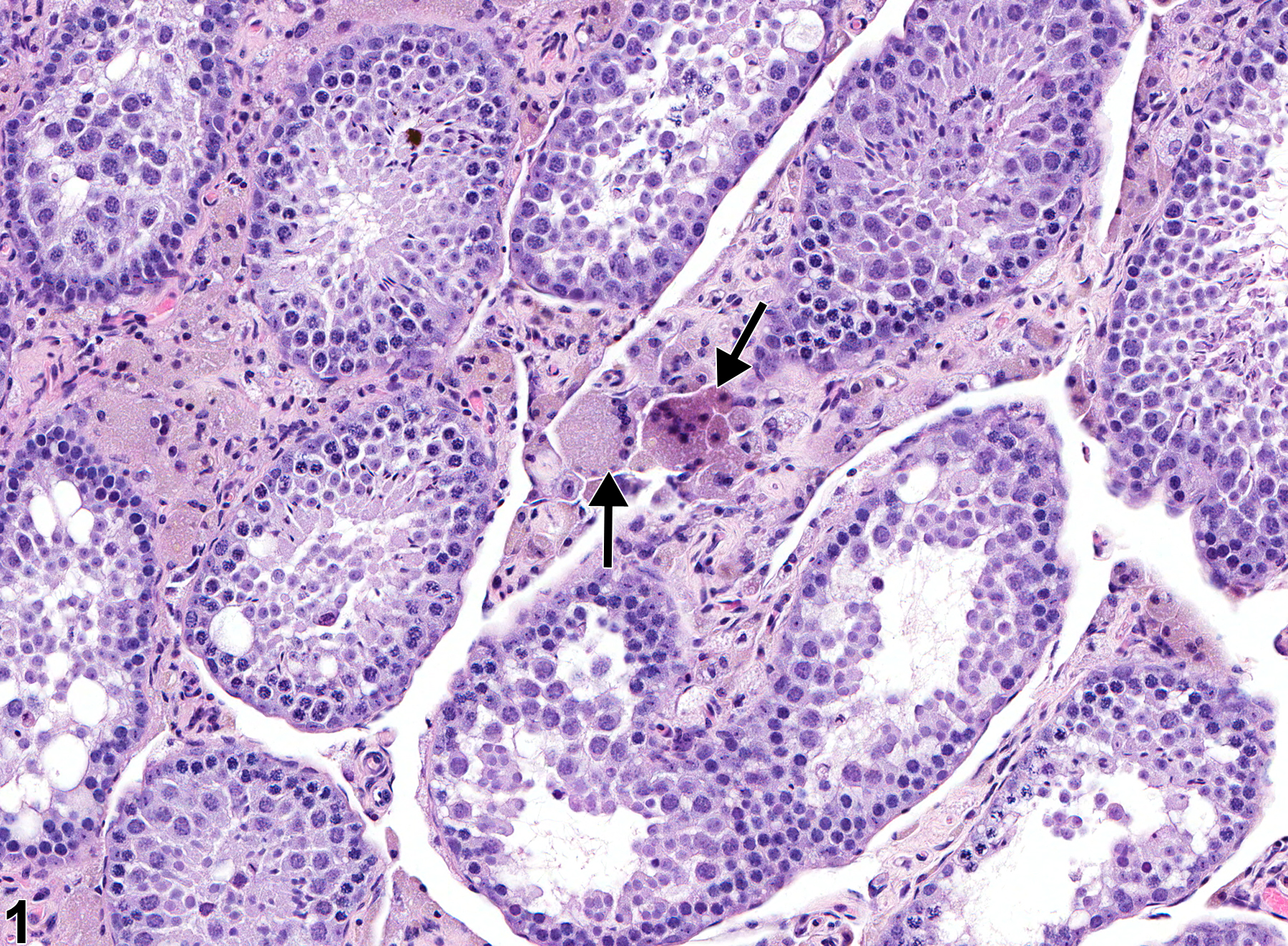 Image of interstitial cell syncytial cells in the testis from a male FVB/N mouse in a chronic study
