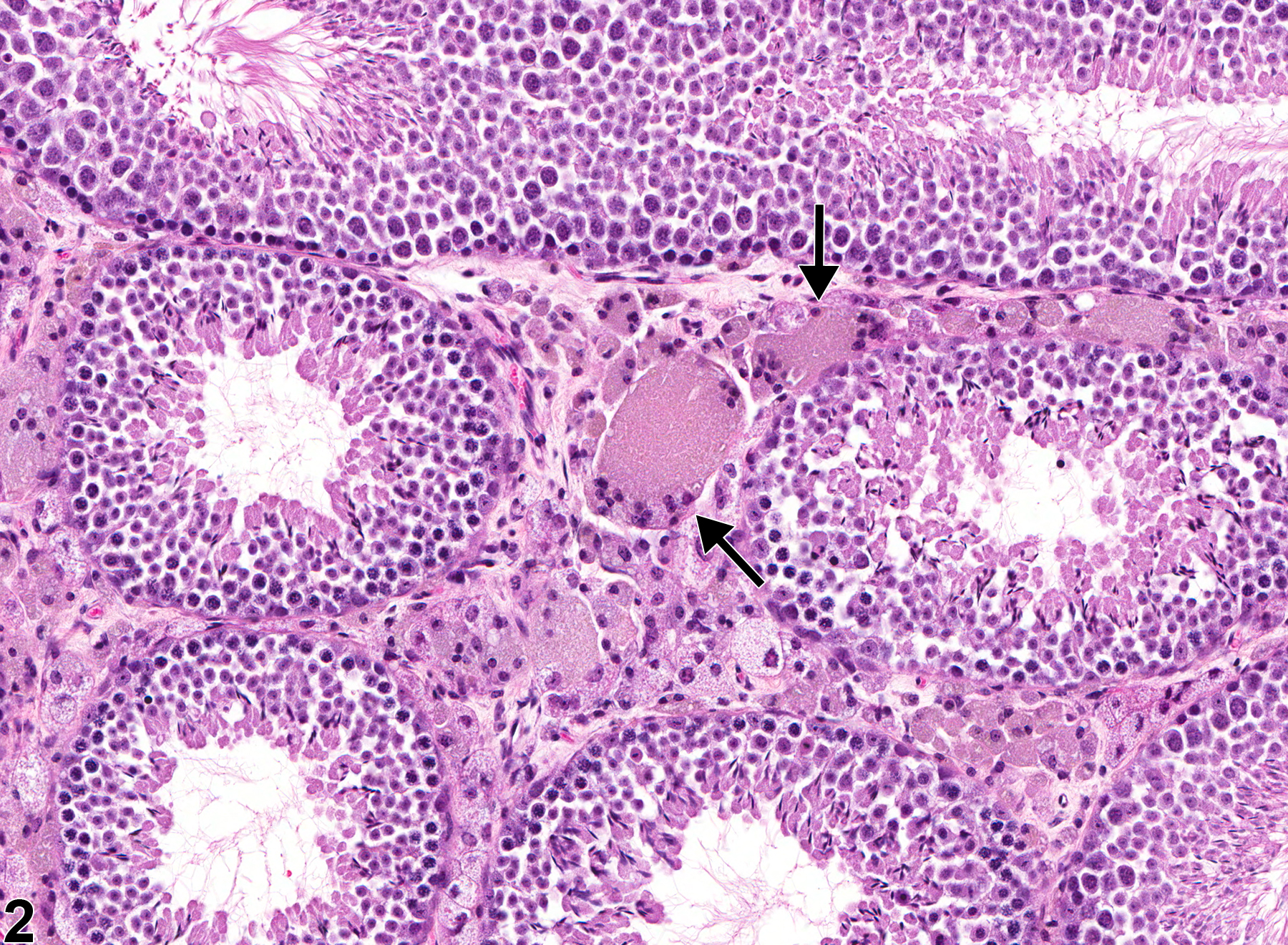Image of interstitial cell syncytial cells in the testis from a male FVB/N mouse in a chronic study