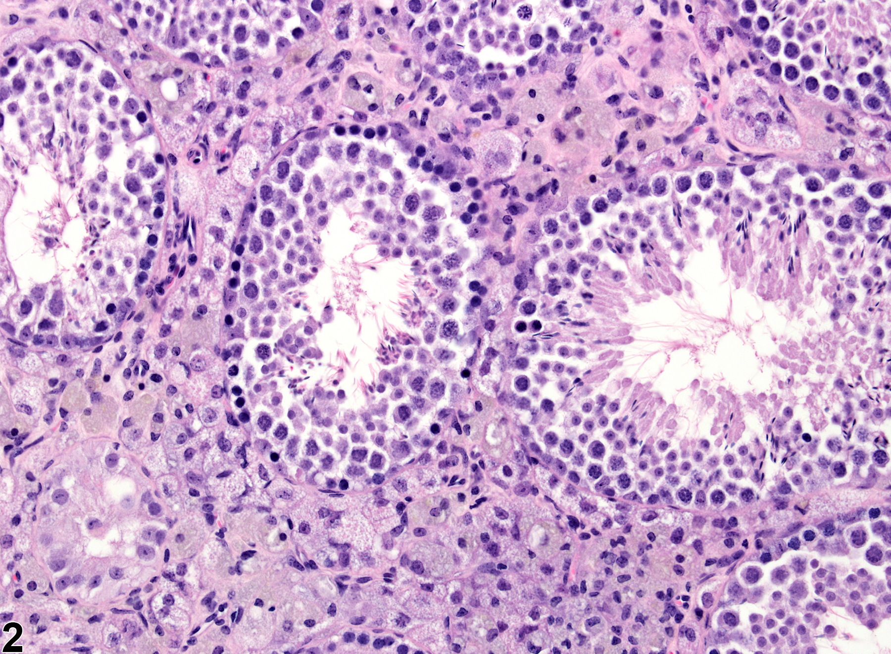 Image of interstitial cell vacuolation in the testis from a male FVB/N mouse in a chronic study