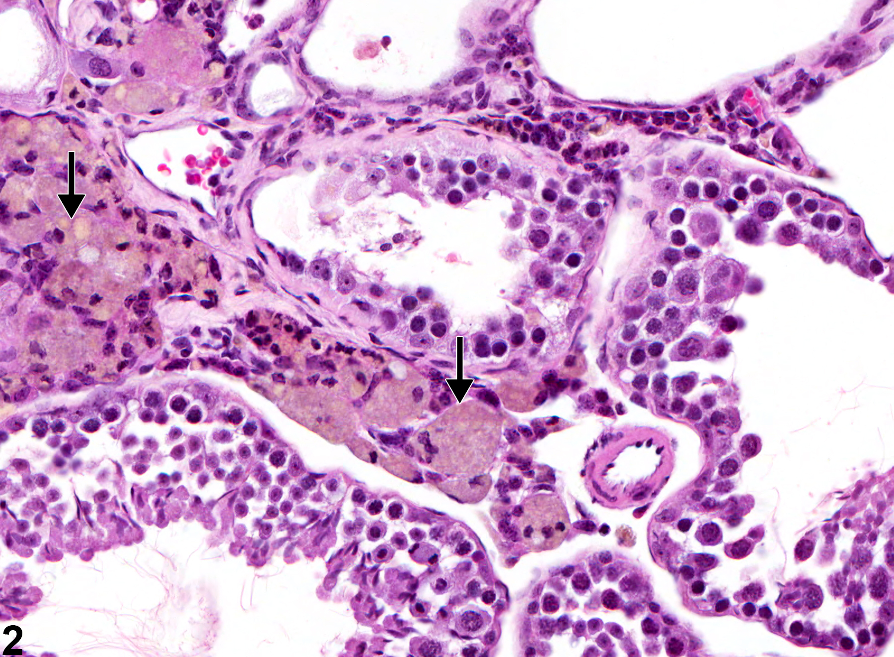 Image of pigment in the testis from a male B6C3F1 mouse in a chronic study
