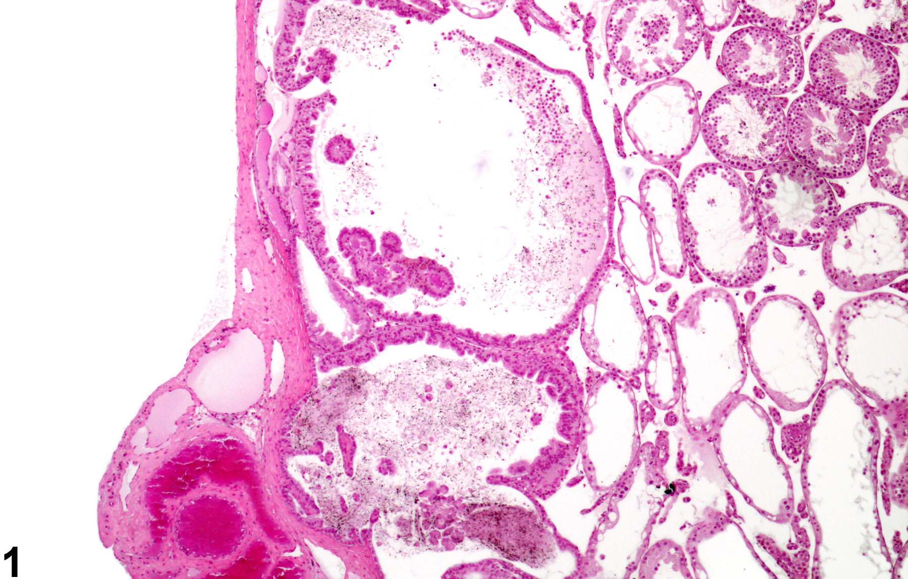 Image of rete testis hyperplasia in the testis from a male CD-1 mouse
