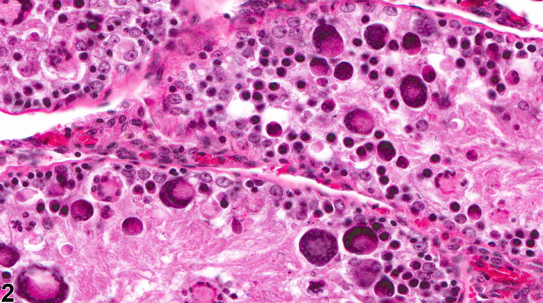 Image of seminiferous tubule giant cells in the testis from a male F344/N rat in a chronic study