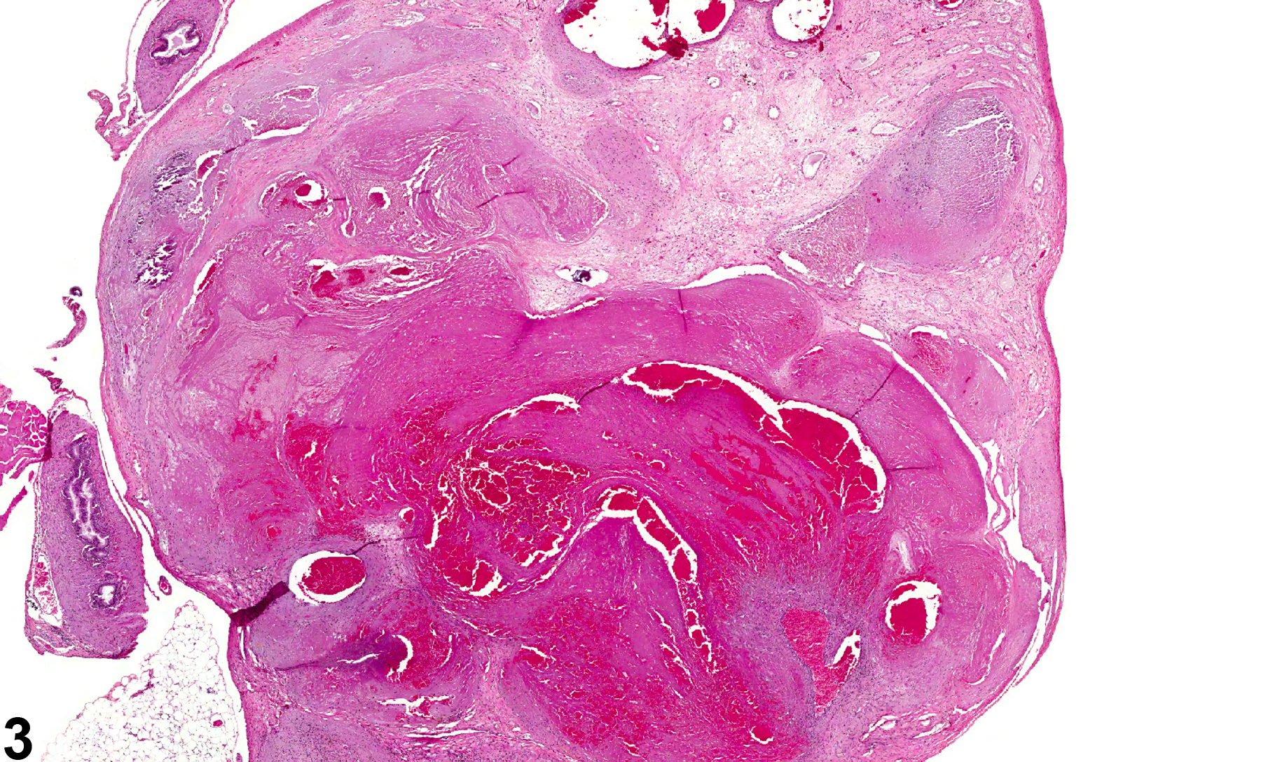Image of seminiferous tubule necrosis in the testis from a male B6C3F1 mouse in a chronic study
