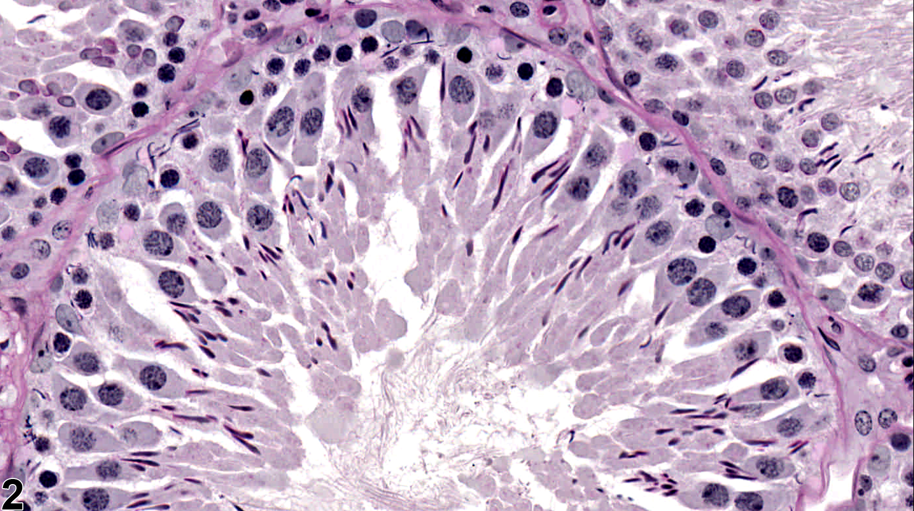 Image of seminiferous tubule spermatid retention in the testis from a male Sprague-Dawley rat