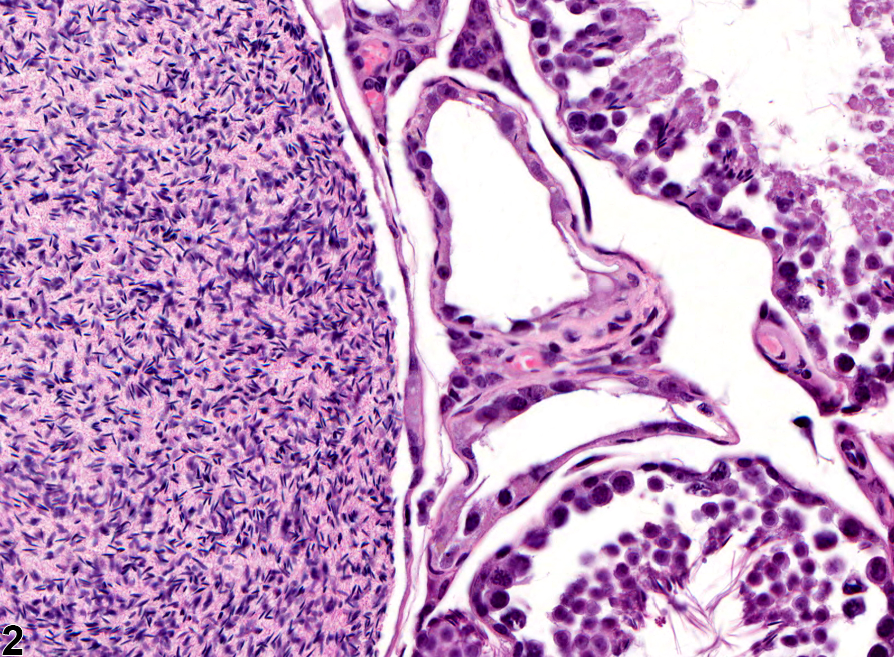 Image of spermatocele in the testis from a male B6C3F1 mouse in a chronic study