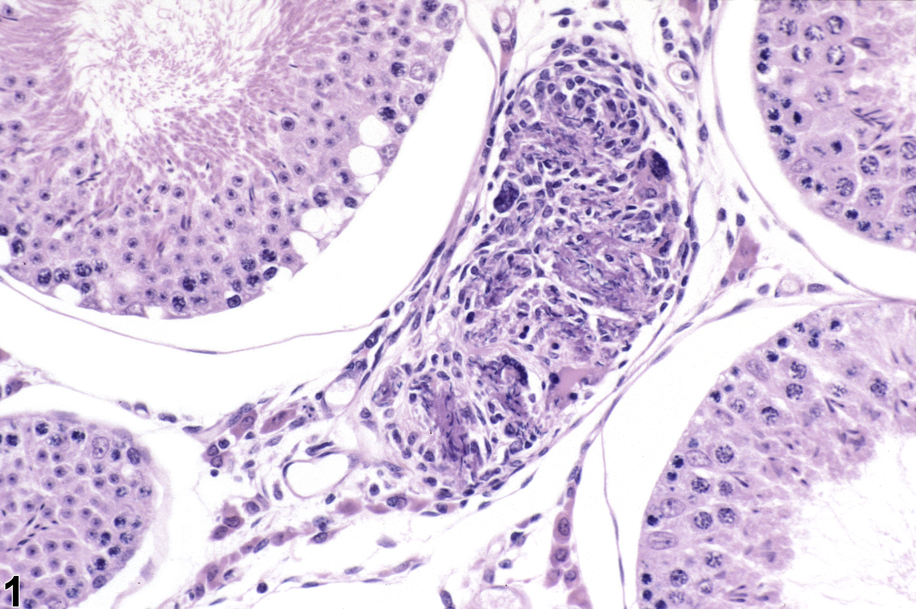 Image of sperm granuloma in the testis from a male hamster in a subchronic study
