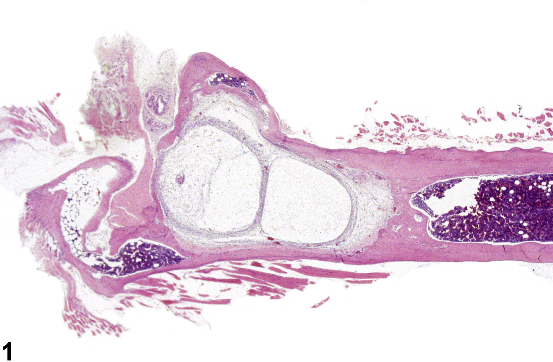 Image of cyst in the bone from a female B6C3F1/N mouse in a chronic study