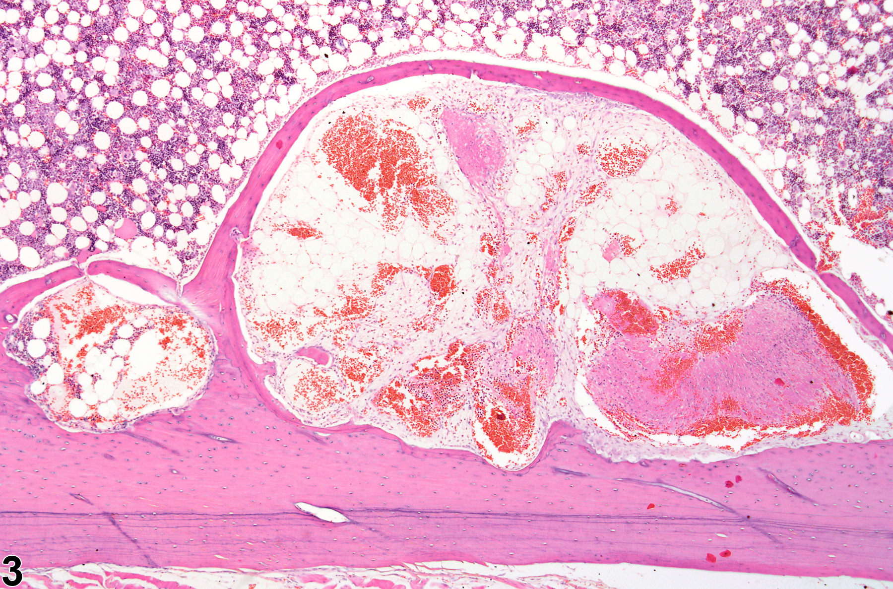 Image of cyst in the bone from a male F344/N rat in a chronic study