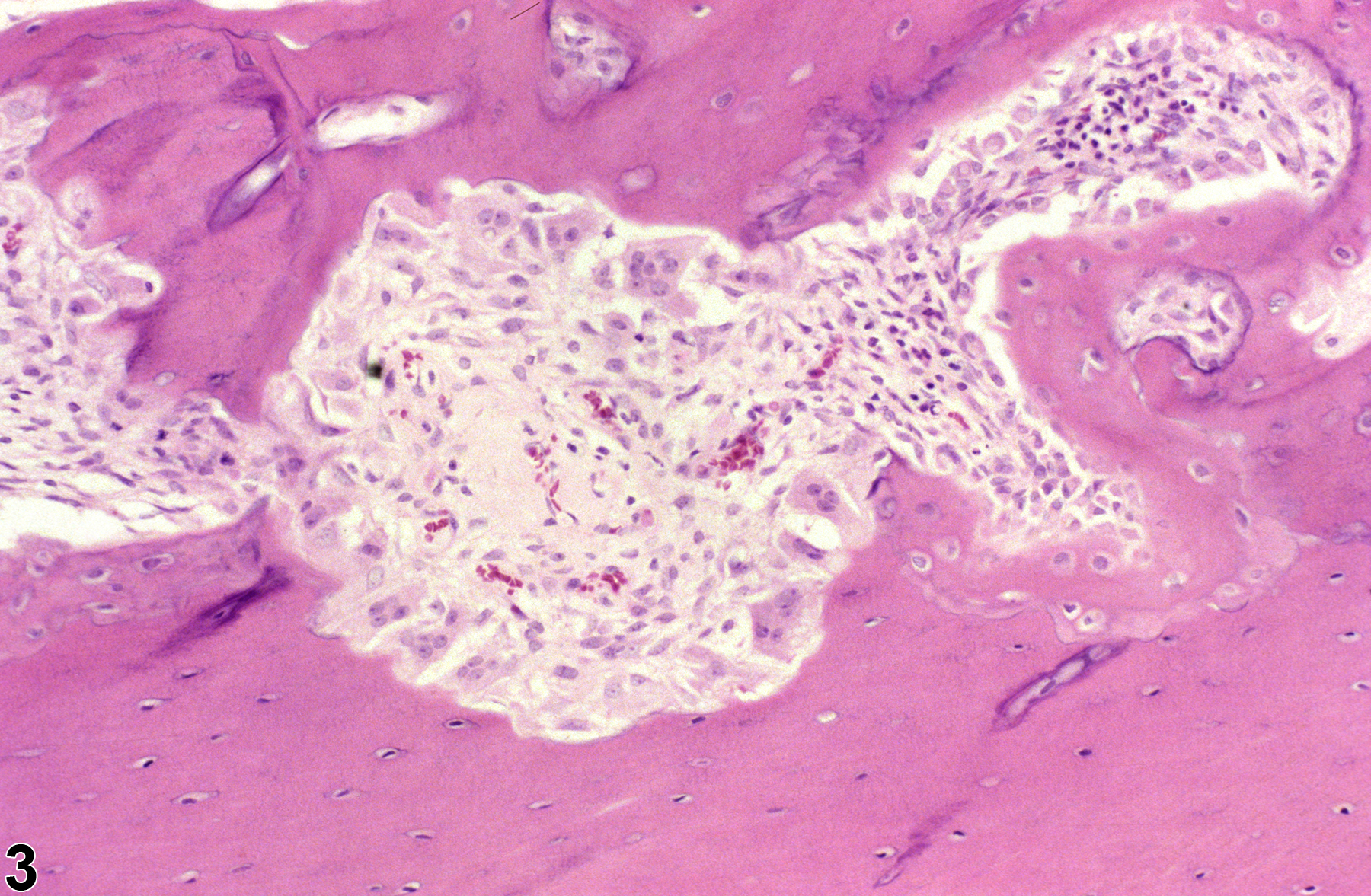 Image of fibrous osteodystrophy in the bone from a male F344/N rat in a chronic study