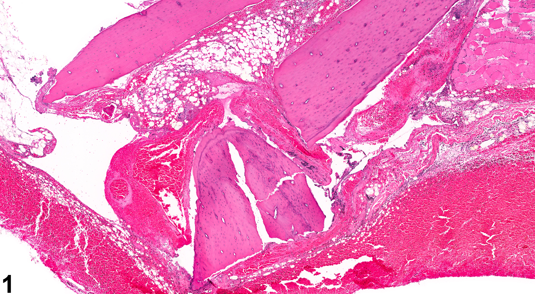 Image of fracture in the bone from a female F344/N rat in a chronic study