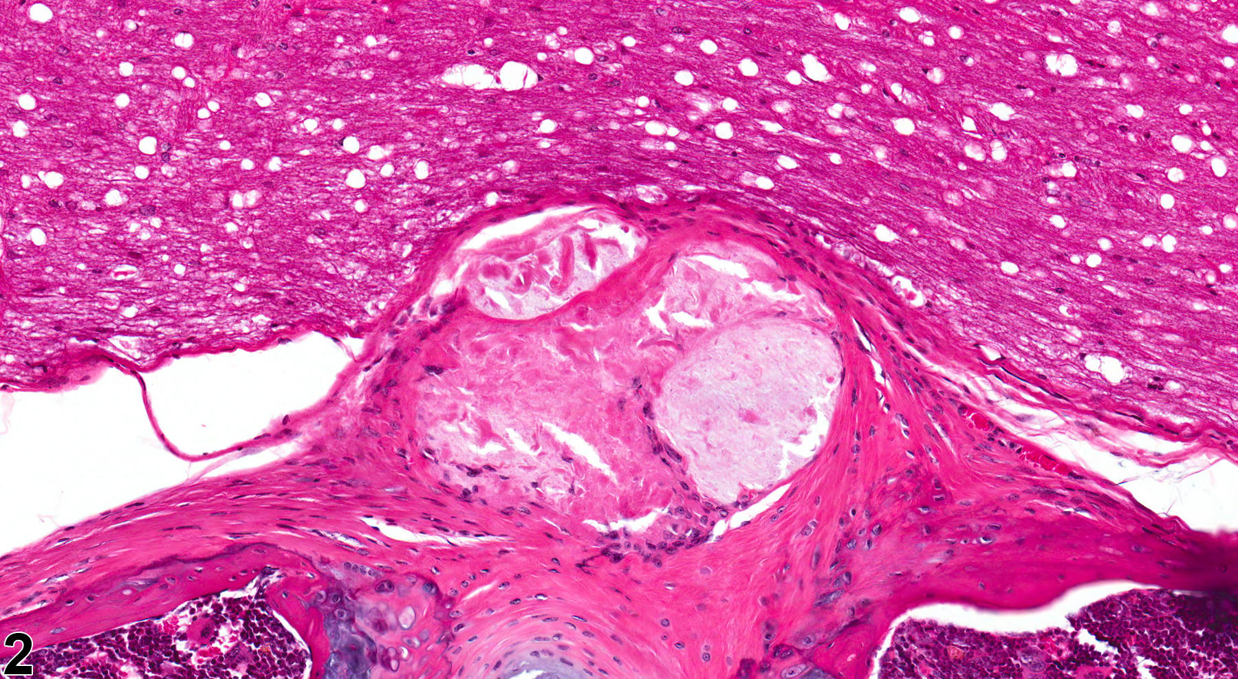 Image of intervertebral disc degeneration in the bone from a male B6C3F1/N mouse in a chronic study