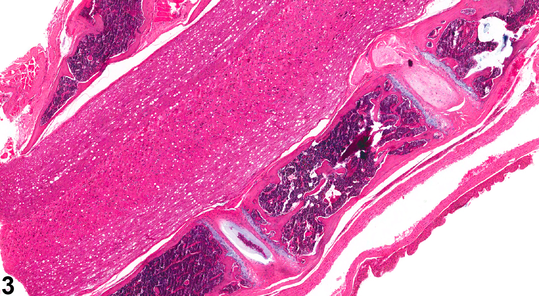 Image of intervertebral disc degeneration in the bone from a male B6C3F1/N mouse in a chronic study