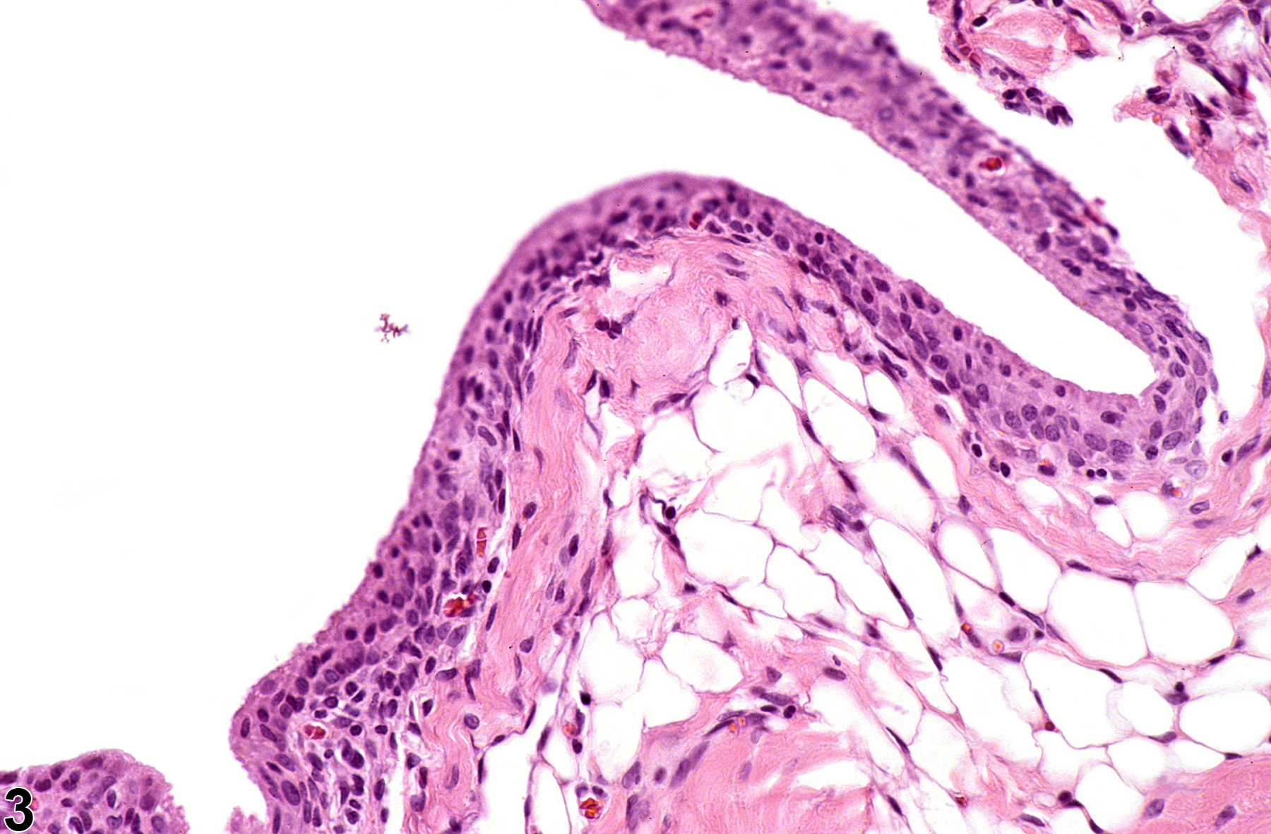 Image of joint degeneration in the bone from a male B6C3F1/N mouse in a chronic study