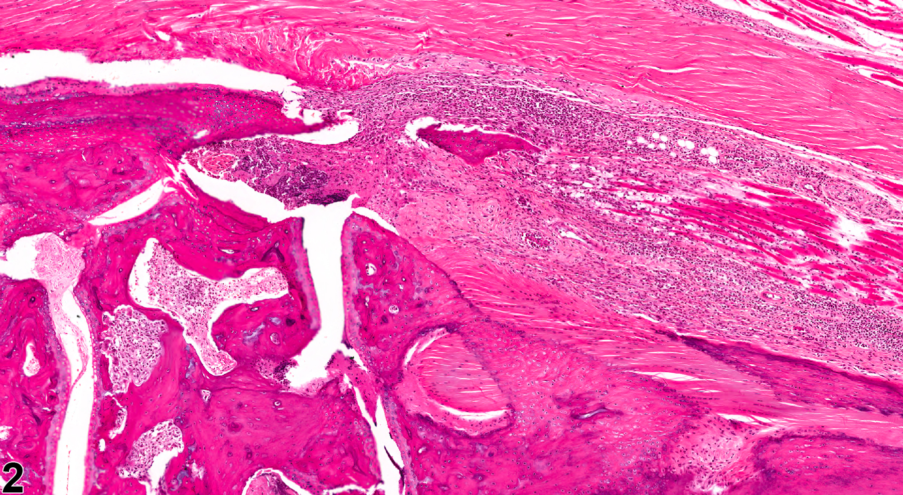 Image of joint inflammation in the bone from a male B6C3F1/N mouse in a chronic study