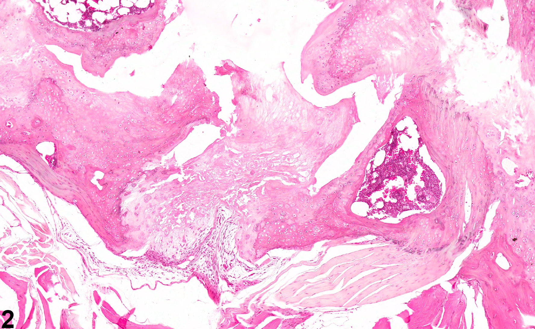 Image of necrosis in the bone from a male B6C3F1/N mouse in a chronic study