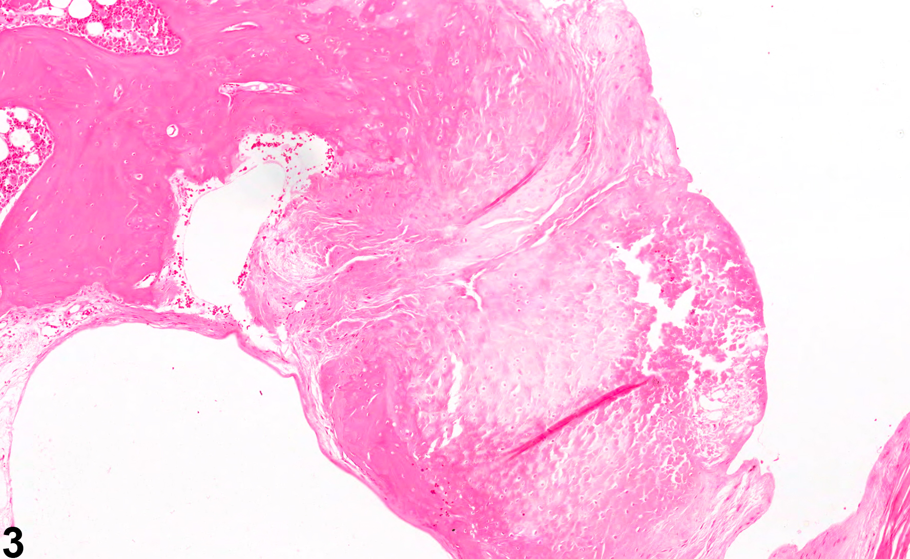 Image of necrosis in the bone from a male F344/N rat in a chronic study