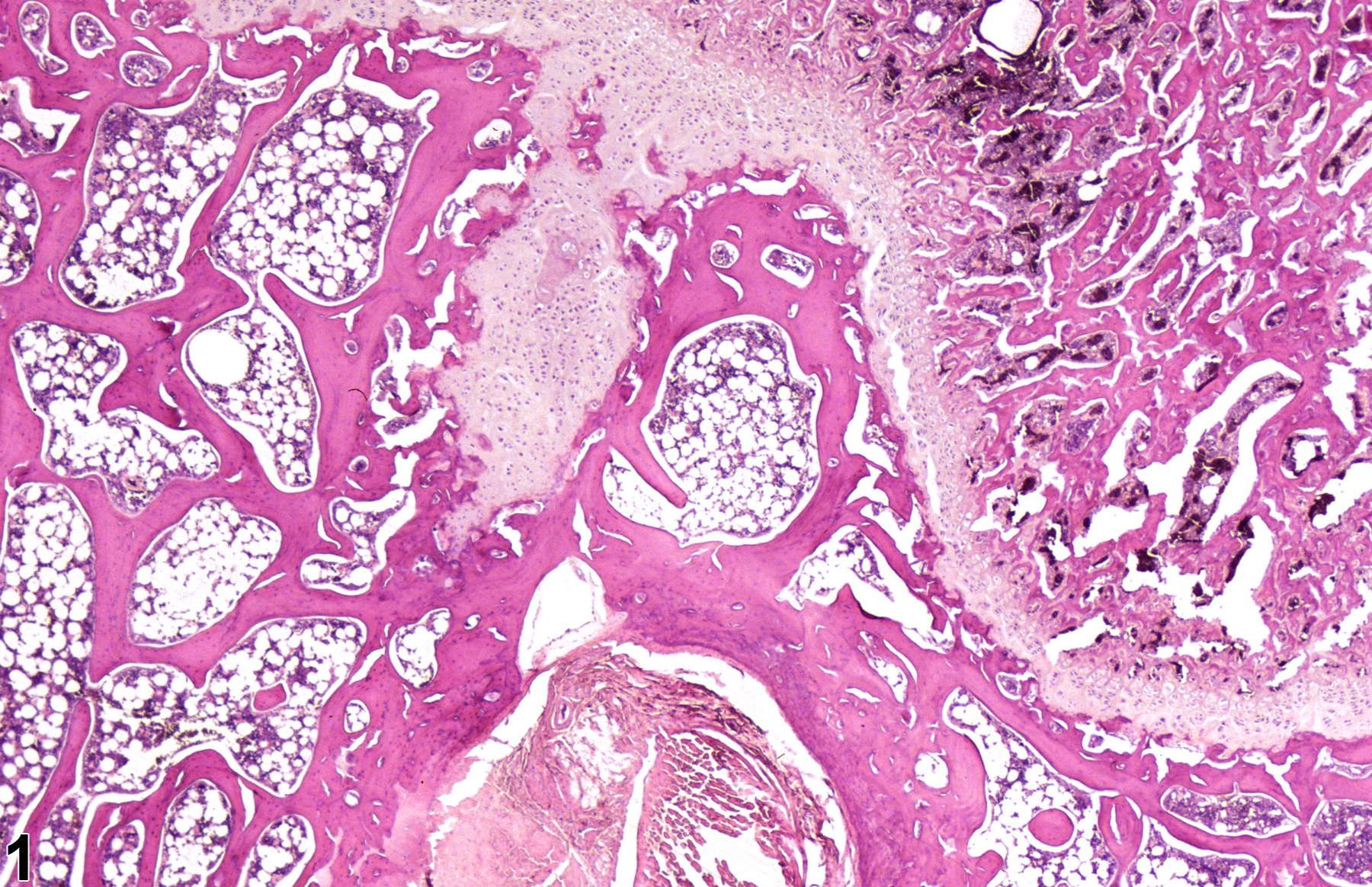 Image of physeal dysplasia in the bone from a male F344/N rat in a subchronic study
